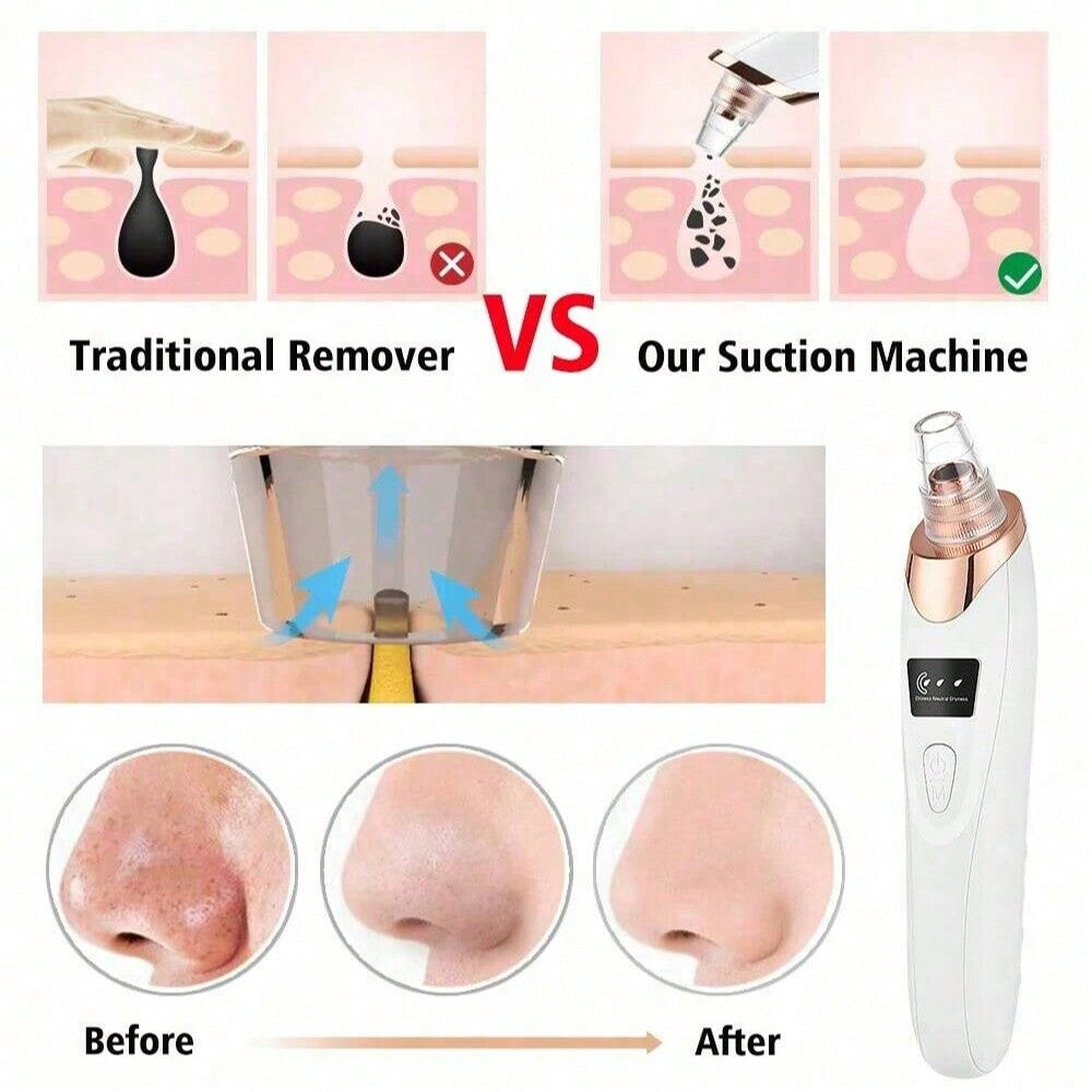 Zariyah™ – Electric Acne Pore Cleaner &amp; Blackhead Remover