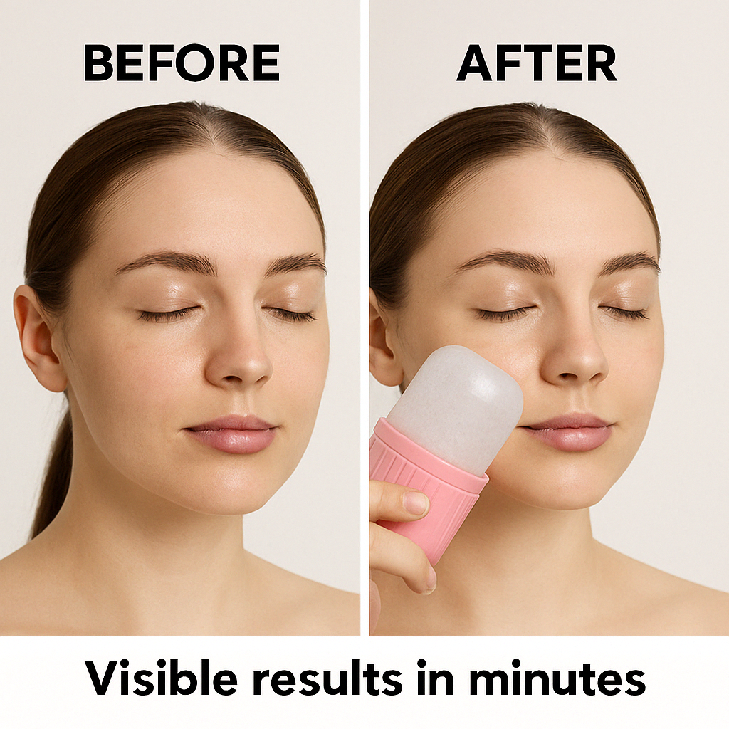 Zariyah™-Ice Face Roller
